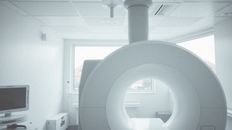Jakie są opinie lekarzy o tomografii bez kontrastu?